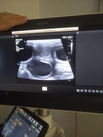 lily pregnant1jpg