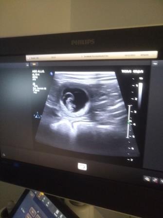 lily pregnant2jpg